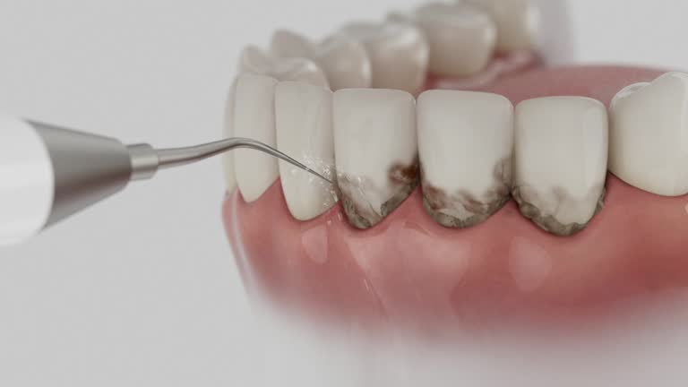 Reliable Emergency Dentist contractor in Aurora, IN by Smile Center Dentistry